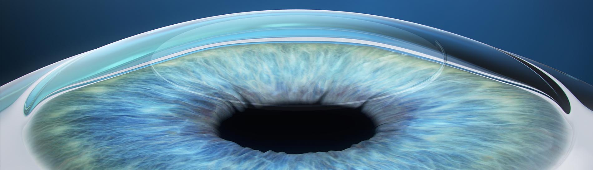 Lézeres szemműtét - a látásjavítás lépései | FocusMed